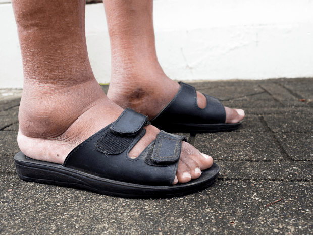 What Diabetic Foot Care Treatments Are Best Left to Your Podiatrist?