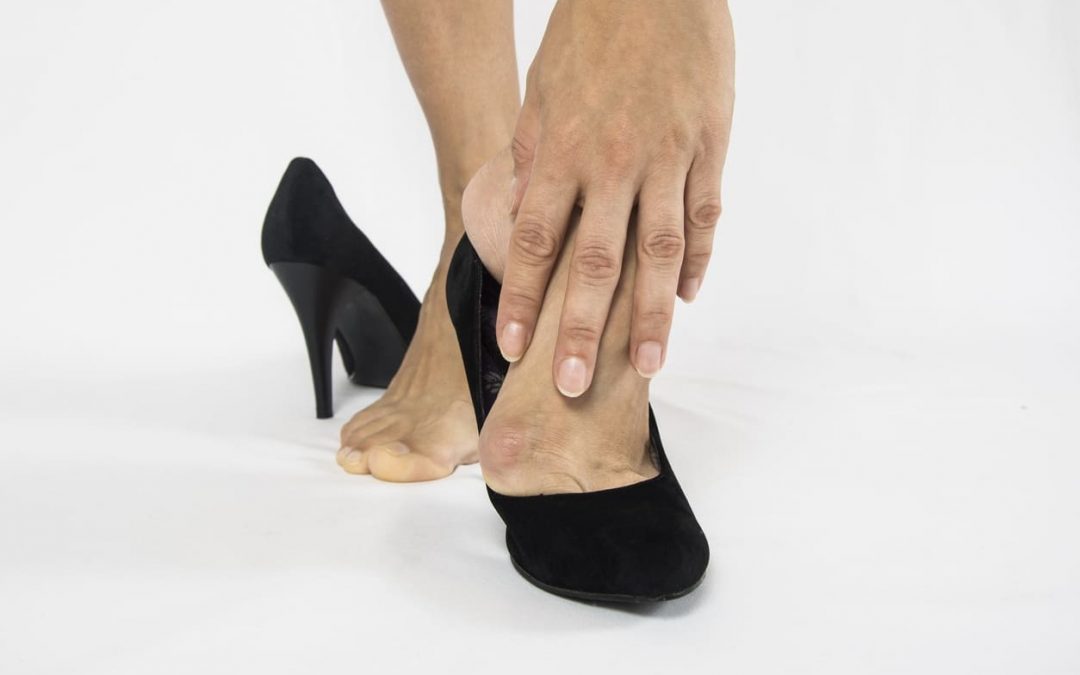 Do High Heels Cause Bunions?