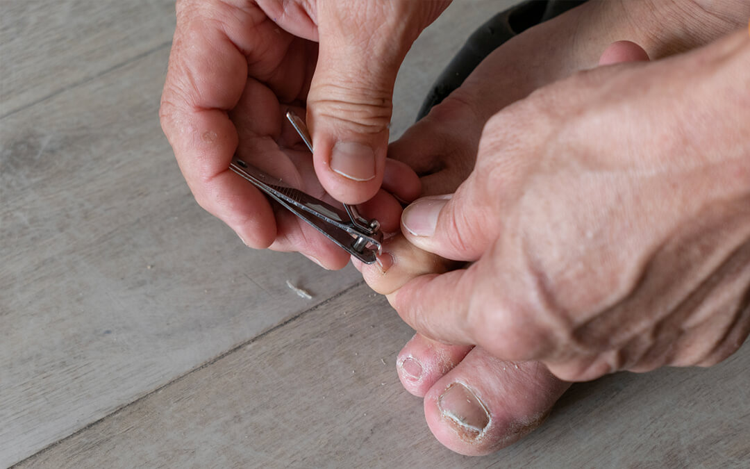The Common Mistakes People With Ingrown Toenails Make