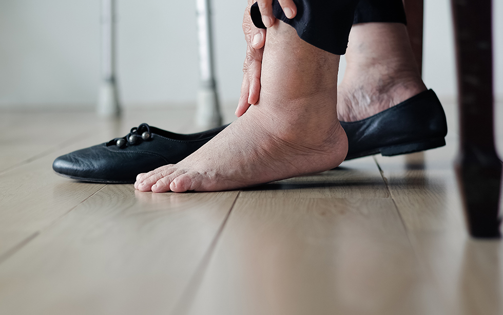 Diabetic Foot Ulcers: Causes and Treatments