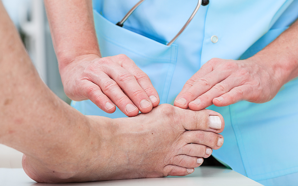 How To Treat A Bunion Before It Gets Worse